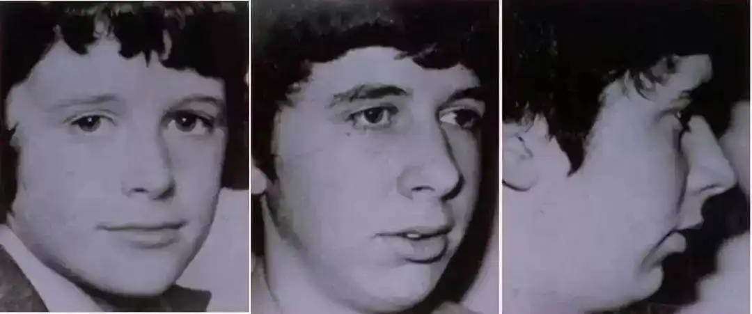 腺样体可引起中耳炎,鼻炎,引起刺激性咳嗽和长期张口呼吸,影响面容的