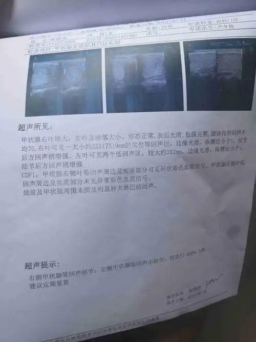 什么意思严不严重?