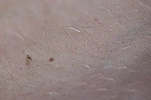 头部,虱子,顶着