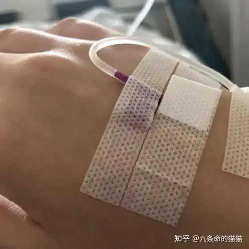 有没有输液的照片我给老师请的病假她要我发照片给她