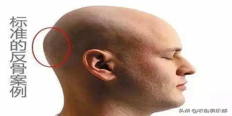 完骨等名字反骨不是一种病那到底这些言论和俗语有没有道理呢不急着