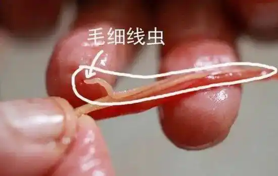 【科普】异尖线虫病科普知识_幼虫