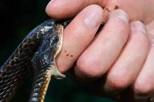 无毒小蛇咬的伤口图片大全