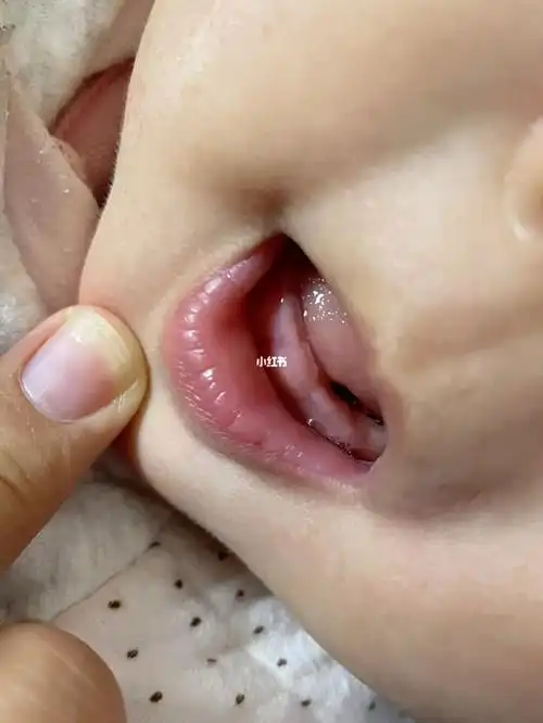 十月份的牛宝宝长牙啦