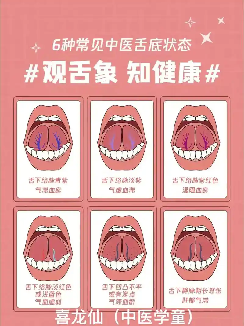 舌象知识分享.#传承中医文化 #分享健康知识 #医学知识科普 - 抖音