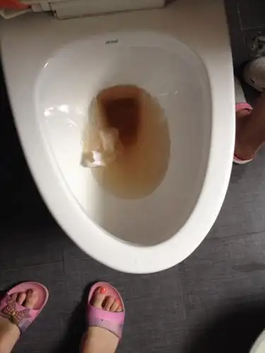 女性内裤总发黄可能与3个原因有关早知早健康