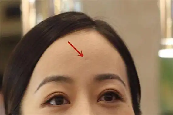 什么叫天庭富贵坑 天庭富贵坑不是每个人都有