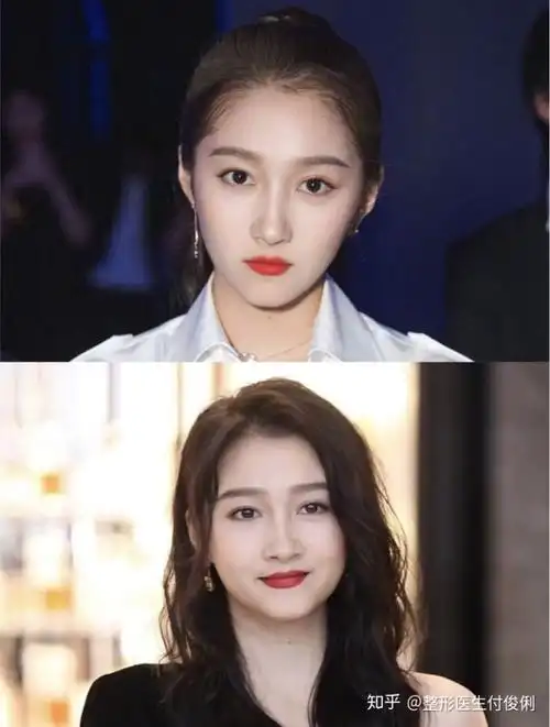 才23岁的关晓彤为什么脸这么快就发腮了