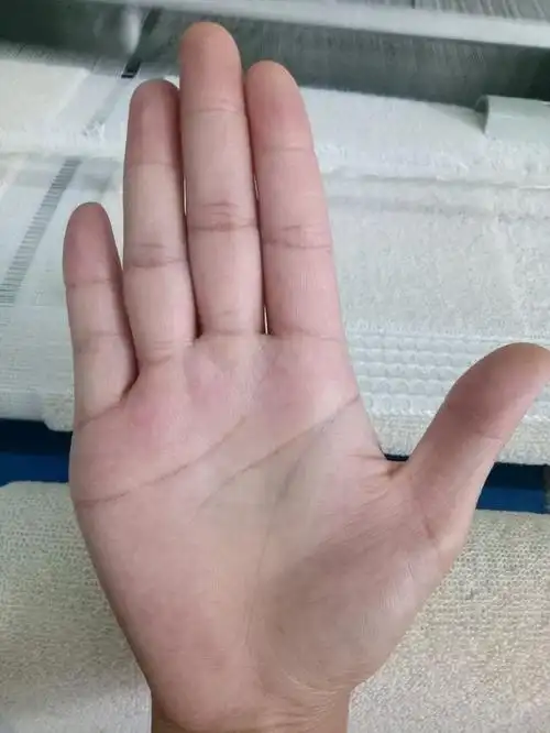 女人手掌纹路像锁链(手掌有锁链纹是啥意思)