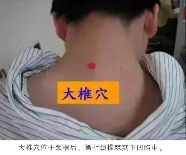 你的脖子后藏着一个大穴,是治颈椎病的特效穴!