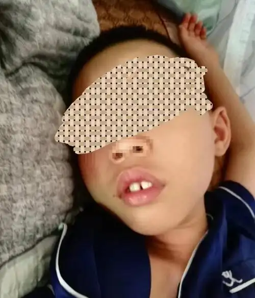 你家孩子有鼻炎,扁桃体肿大,腺样体肥大的问题吗?