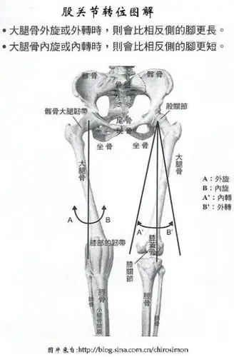 股关节转位图解(转)