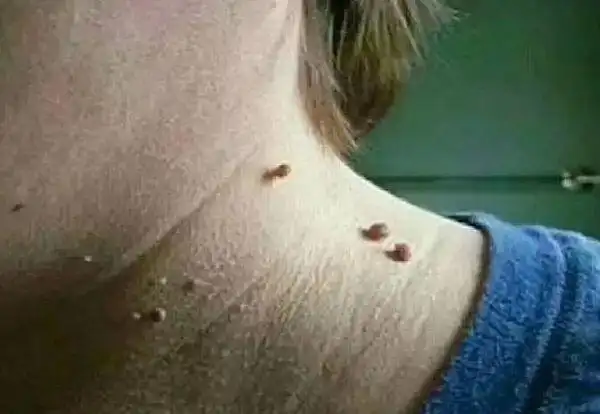 这4种男人易携带hpv女人要学会拒绝尤其是第一种见到快跑