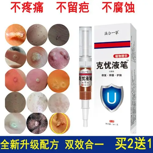 丝状疣体脖子膏颈部肉刺瘊子尤立净克疣霜液腋下除皮赘去优灵笔