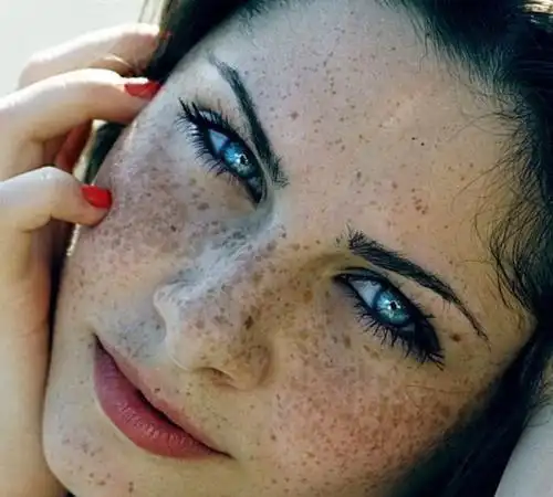 ps去除斑点素材,photoshop 怎么去除照片上斑点图1