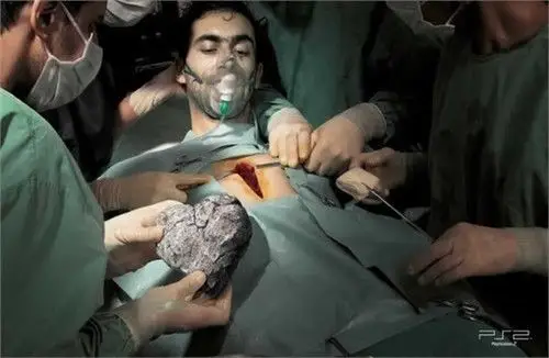 解剖小人真实奉献如临现场