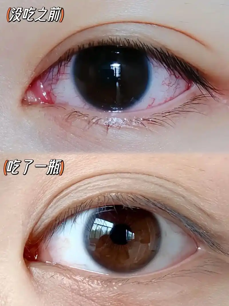 蓝莓叶素黄软糖!你吃了吗?呵护眼睛!就要从在现在起!!