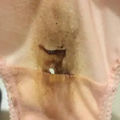 本人快38周 刚吃饭前上厕所看到这样一点点的分泌物 是要生了的状态吗