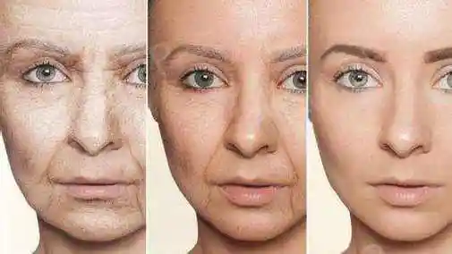 皱纹是岁月在脸上划过的痕迹,随着年纪越来越大,各种皱纹也越深,尤其