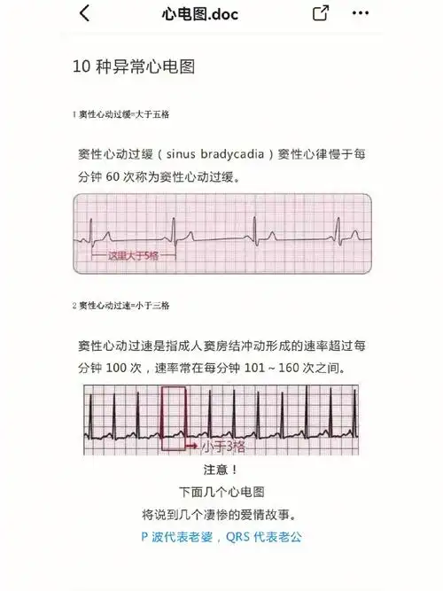 22护理考试心电图总结出来口诀记忆哈哈