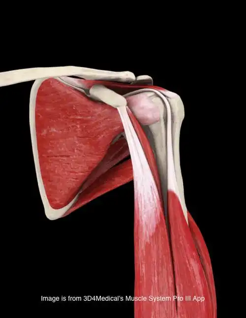 肱二头肌肌腱炎