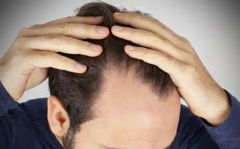 男人如何护发 男性护发方法 男人怎么保养头发