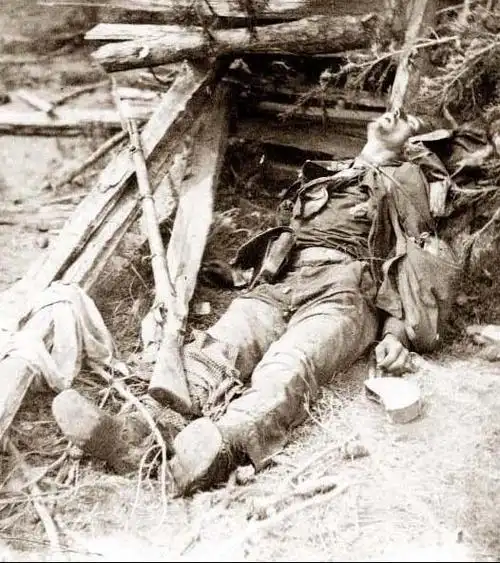 似曾相识:19世纪美国内战尸横遍野[组图]