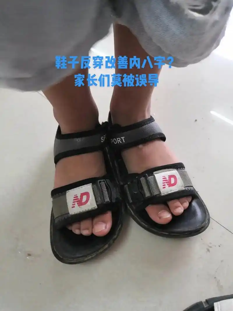 鞋子反穿改善内八字?家长们莫被误导.生活中有不少的孩子是内八 - 抖