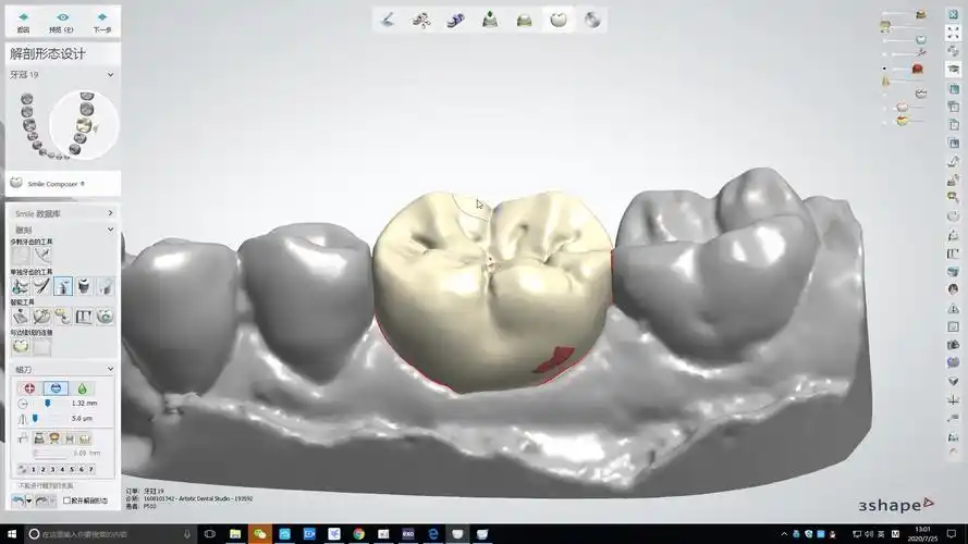 牙宝带你学习3shape下颌6号牙设计方法