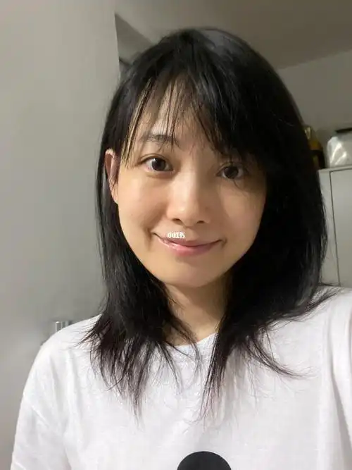 36岁无p图素颜,使用维a酸乳膏两年