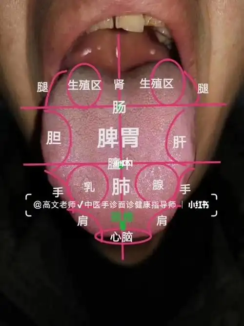 舌诊 78看舌诊知健康,舌头的不同部位反映了不同的五脏六腑 ,学习