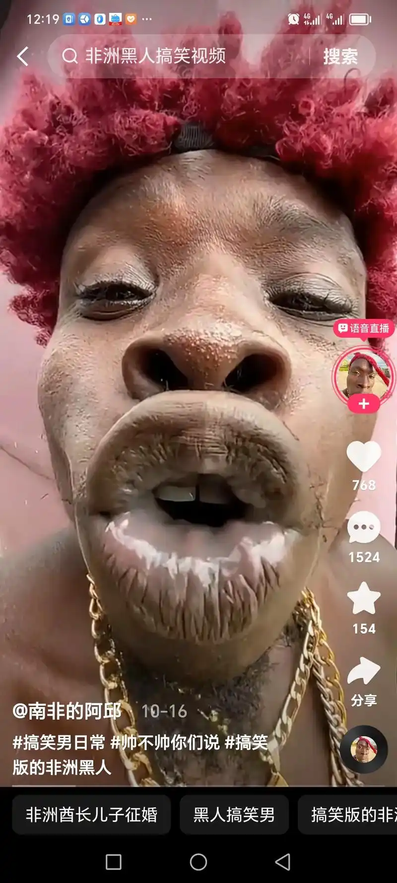 南非的阿邱·07-09 非洲酋长儿子吃鸡蛋 894 589 - 抖音