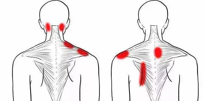锦章堂丨引发肩膀疼痛除了肩周炎,还有哪些病因?_诊断