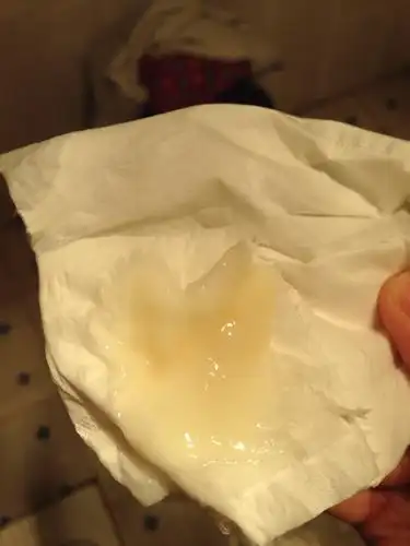 请问 如何瘦腰 a4腰? 感激不尽