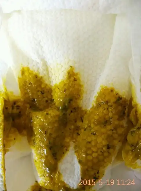 宝宝6个月,昨天给吃了香蕉泥,今天拉了这样的大便,有黑色小条条的东西