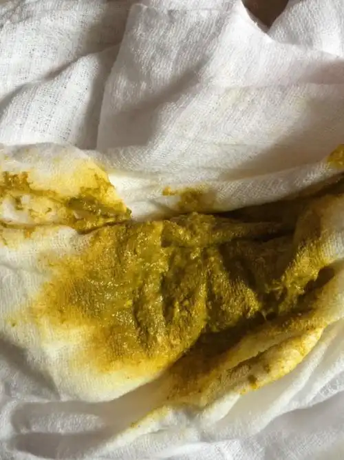 母乳喂养,宝宝一个多月.经常几天不大便,用开塞露才便,这样是不是