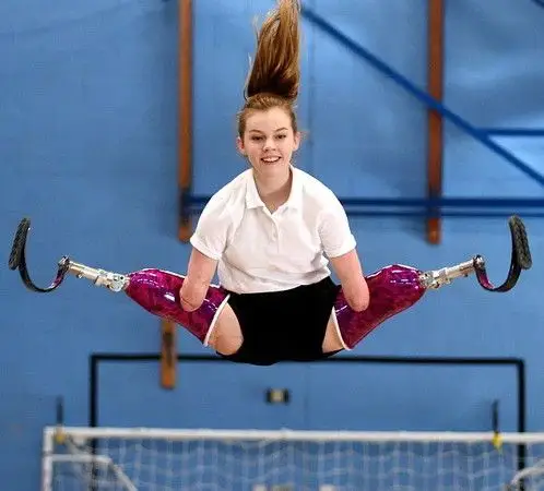 台媒:英国无四肢女孩表现完美赢得全英蹦床冠军