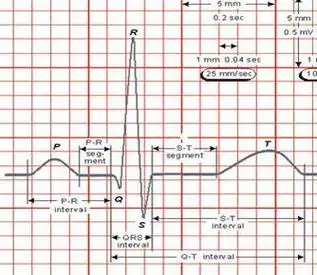 p>窦性心律的心电图必须符合下列两个条件:(1)p波在Ⅰ,Ⅱ,avf导联