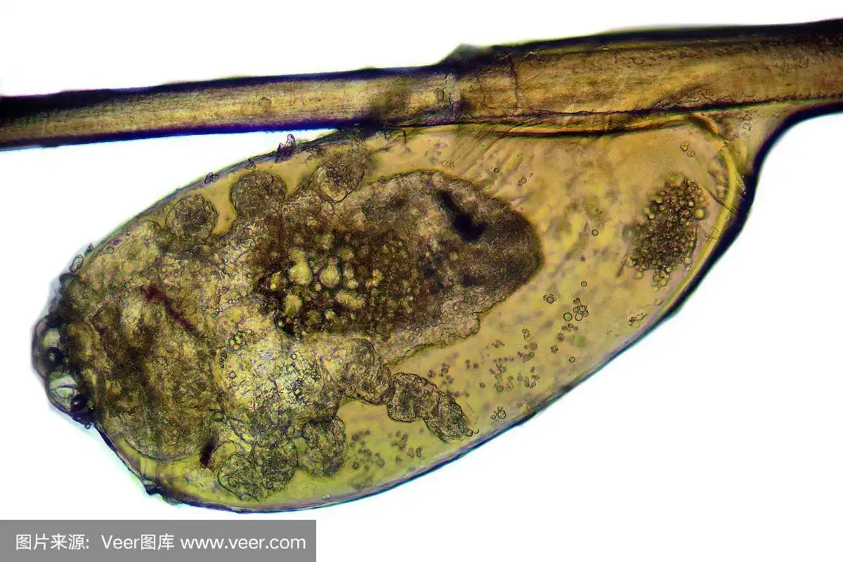 头虱-头虱,显微镜照片,发丝带虱卵