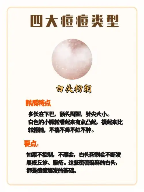 痘肌干货丨四大痘痘类型自测辨别60