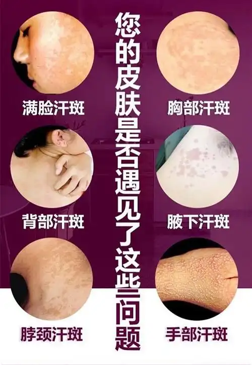 您 :请正确认识化妆品功效,化妆品不能替代药品,不能治疗皮肤病等疾病