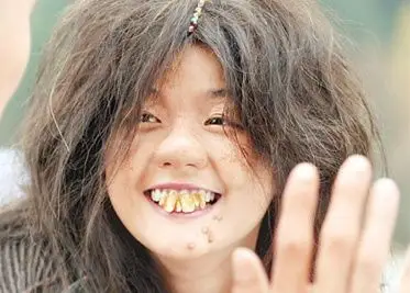 女神龅牙雷死人——盘点影视剧中经典的龅牙妹