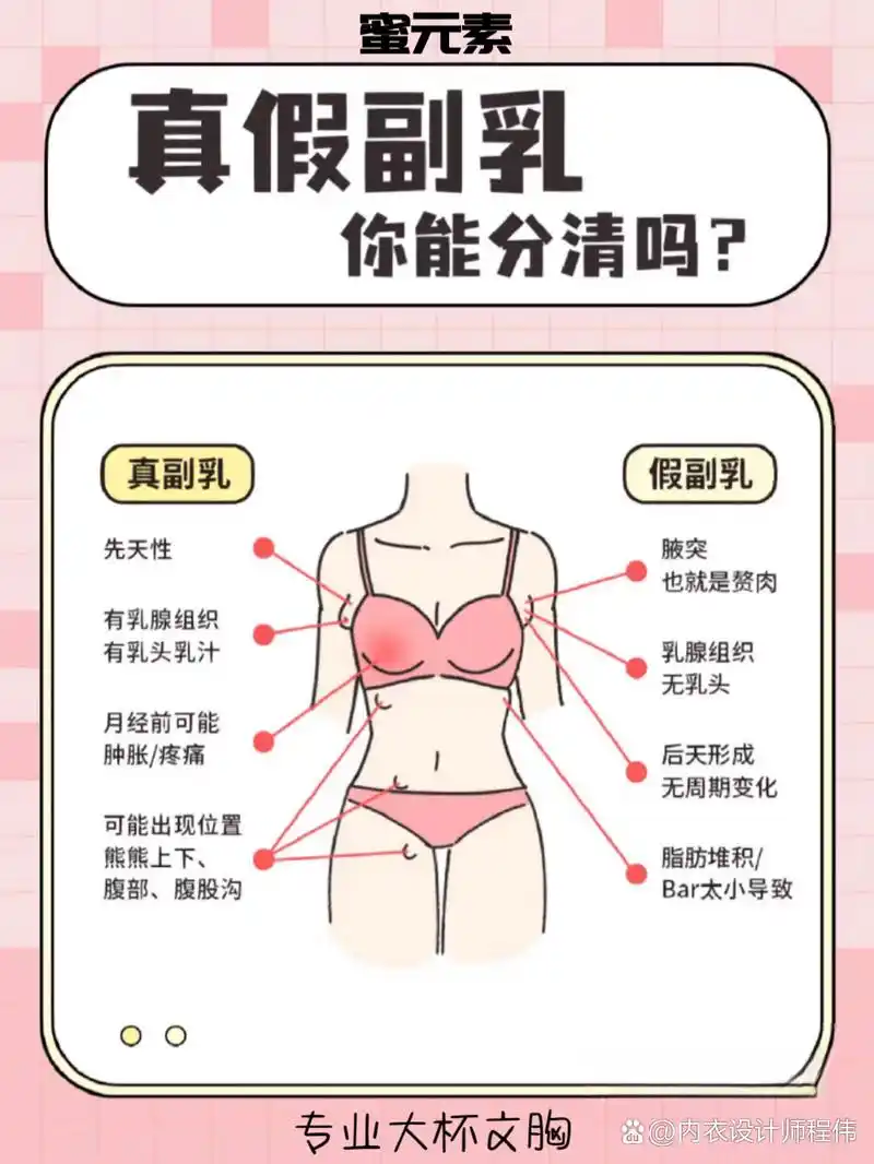 一篇教你分辨(内含消除法) 如何分辨真假副乳 【真副乳】 1.
