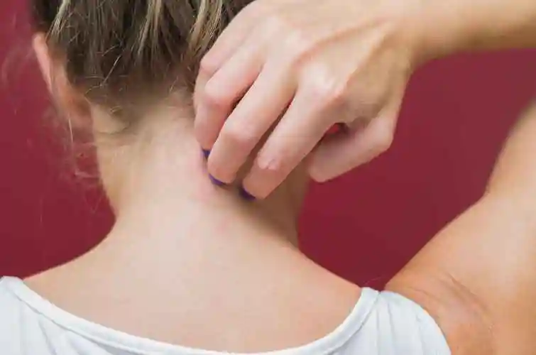 当发生毛囊炎时,头部会出现一些红色的小丘疹.