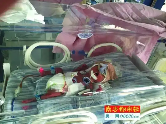 双胞胎中的哥哥.