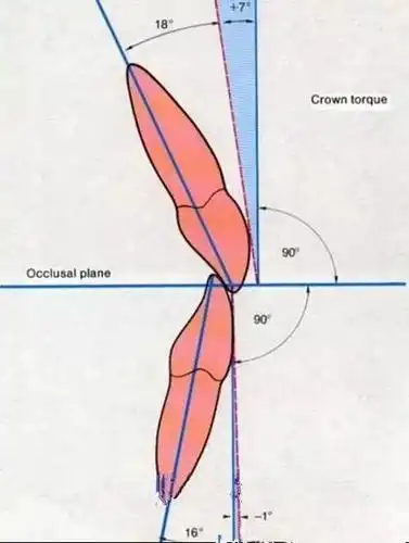 正常牙齿排列是这个样子,看看你的是否正常?