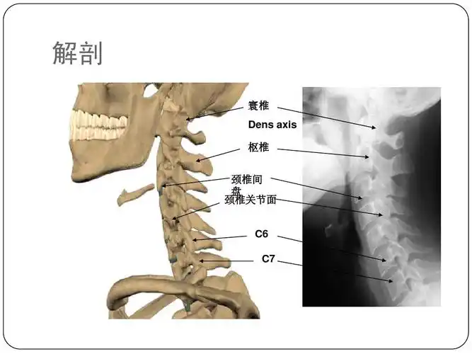 颈椎病康复ppt_word文档在线阅读与下载_免费文档