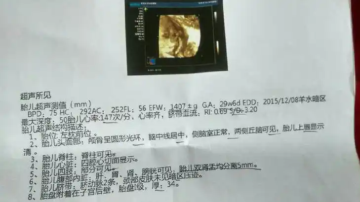 b超单上4个字,并非宝宝生病,可能暗示男宝已在腹中,偷着开心吧_检测