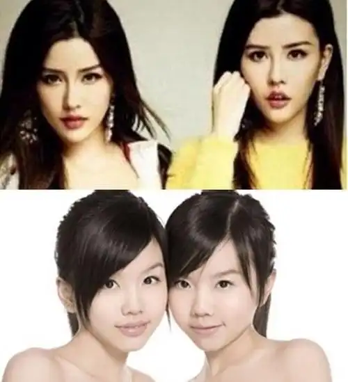 【"by2姐妹"8年来整形过程大公开!