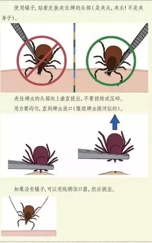 春游踏青谨防蜱虫叮咬